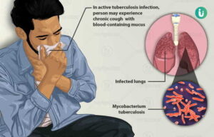 World Tuberculosis Day poster 2024